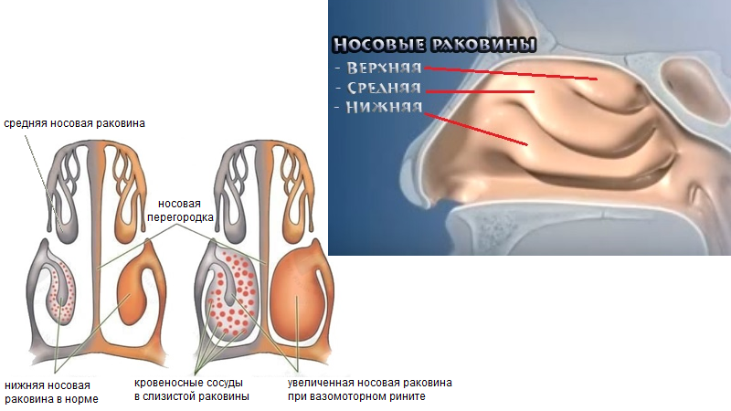 Конхотомія: що це таке?